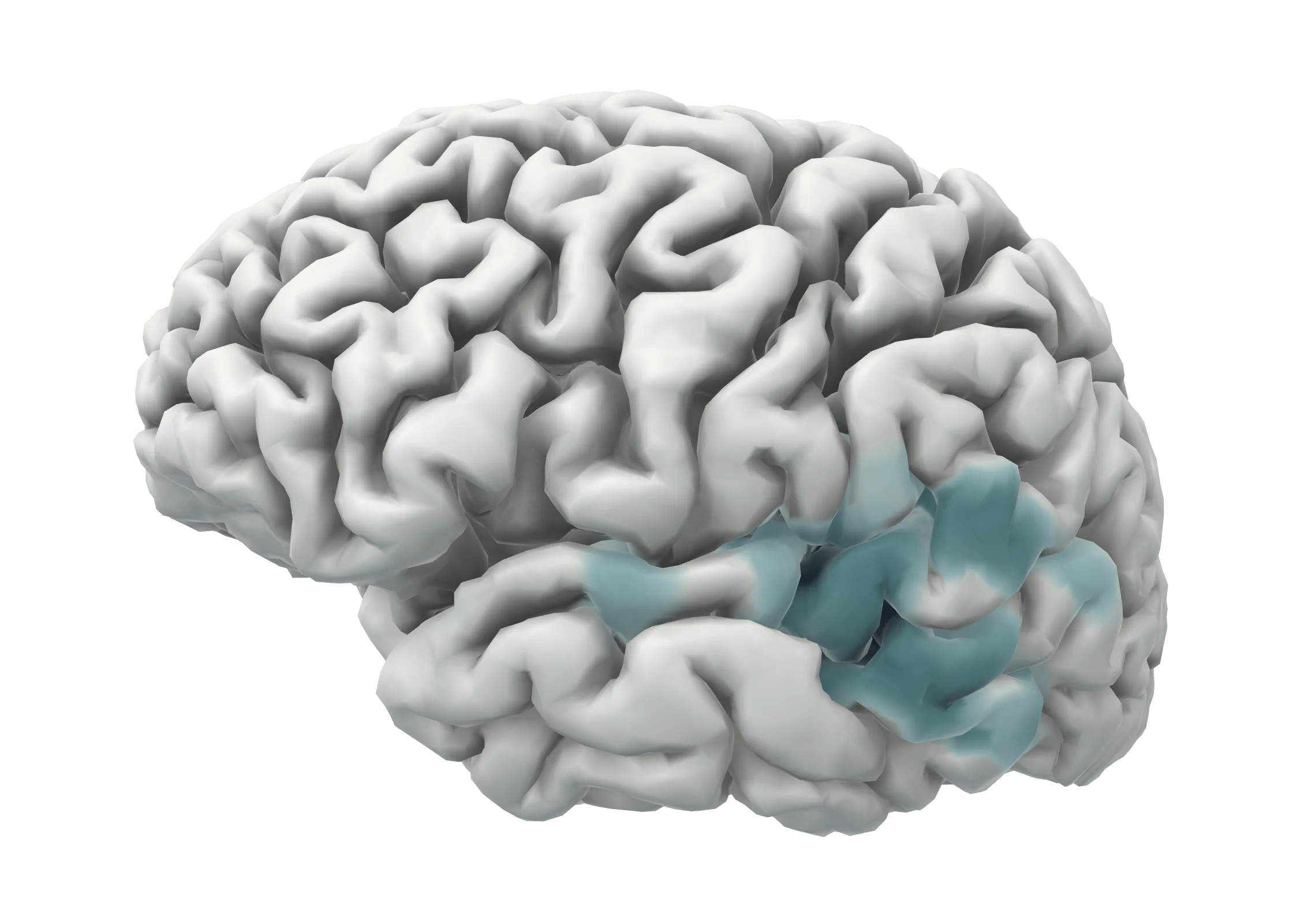 Left hemisphere of a human cortex. A shaded area around the Sylvian fissure and the upper temporal lobe marks where the source estimate is strongest.
