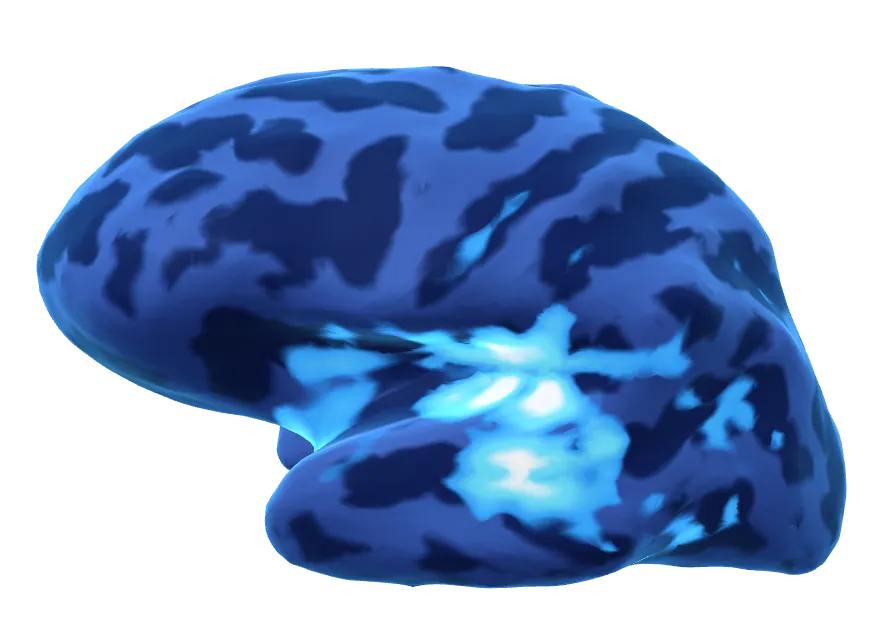 Inflated left hemisphere 75 milliseconds after tone onset; the estimate is concentrated around the auditory cortex.