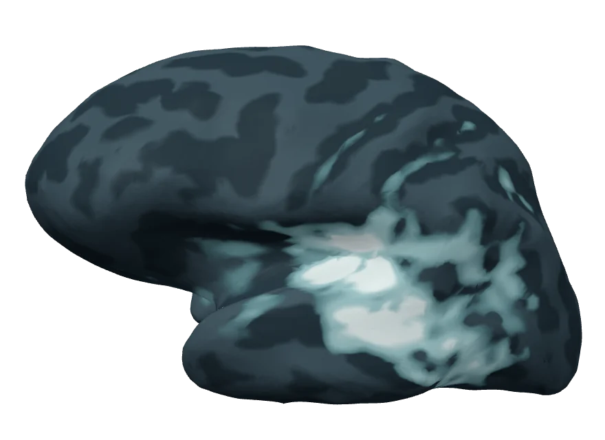 Inflated left hemisphere 92 milliseconds after tone onset; the estimate is strongest, centred on the auditory cortex.