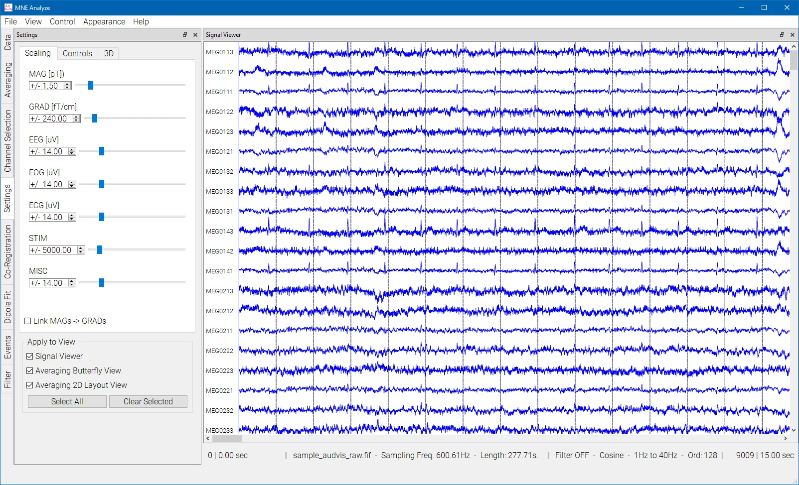 Screenshot of MNE Analyze: a settings panel on the left and a signal viewer with about twenty MEG channel traces on the right.