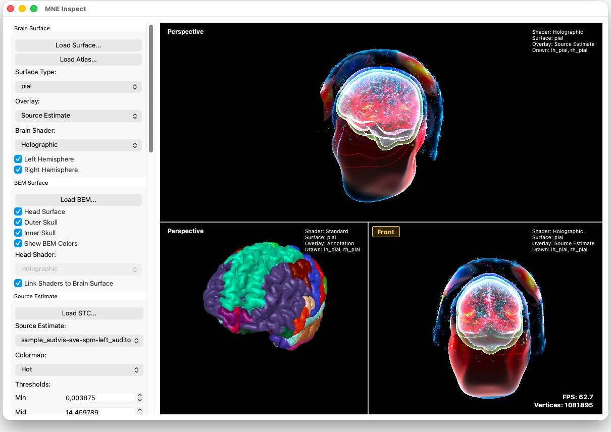 Screenshot of MNE Inspect with three 3D views of a head and brain: two with a source estimate drawn on the cortex inside a transparent head, one with the cortex coloured by atlas region.